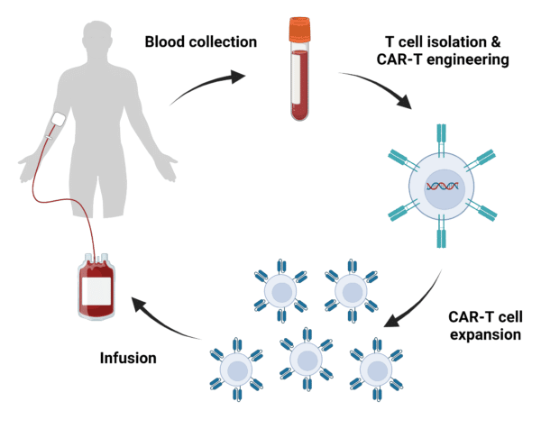 CAR-T cell therapy process. Blood collected in a vial for T cell isolation and expansion, followed by infusion back into the patient.