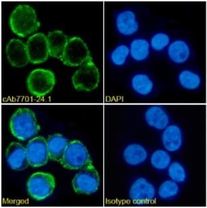 polyclonal antibodody sequencing and characterization with MS based antibody discovery and characterization